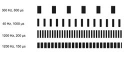 spine