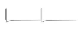 spine